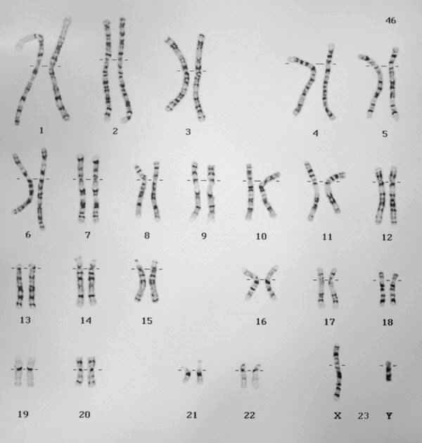 2x23 chromosomen